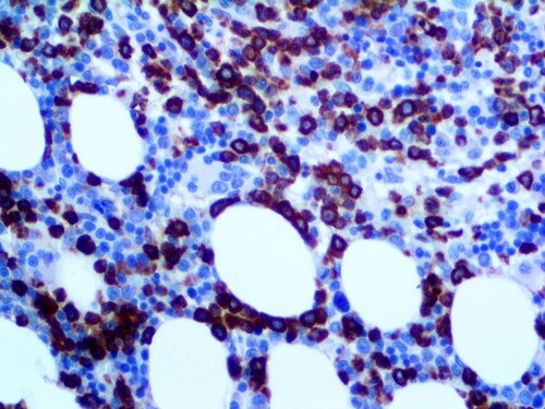 IHC of Myeloperoxidase on an FFPE Bone Marrow Tissue